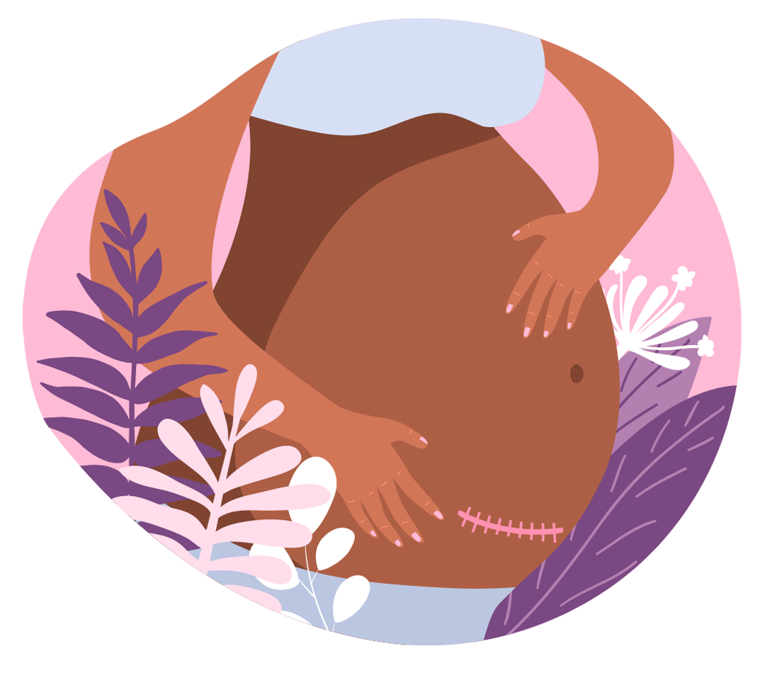 C Section Birth Options